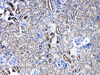 Anti-Protein C inhibitor/SERPINA5 Antibody