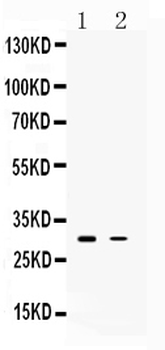 Anti-TSG6/TNFAIP6 Antibody