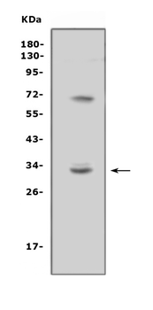 Anti-TREML1 Antibody