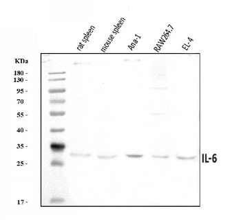 Anti-IL6 Antibody