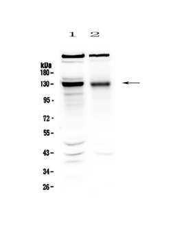 Anti-BMPR2 Antibody