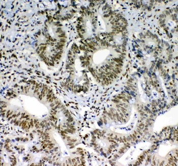 Anti-PRDM1/Blimp1 Antibody