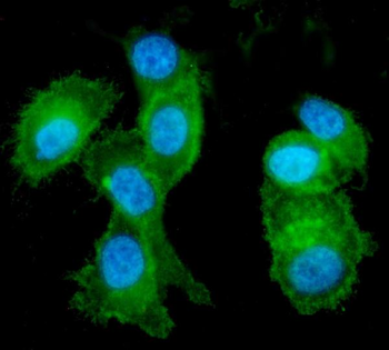 Anti-Eph receptor A2/EPHA2 Antibody