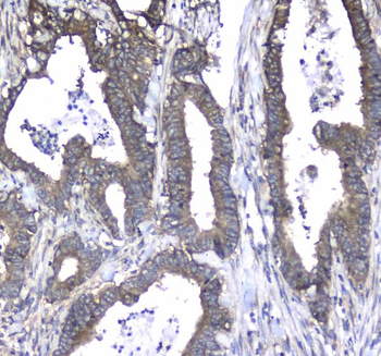 Anti-L1CAM Antibody