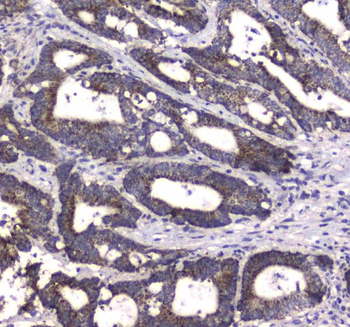 Anti-MRE11/MRE11 Antibody