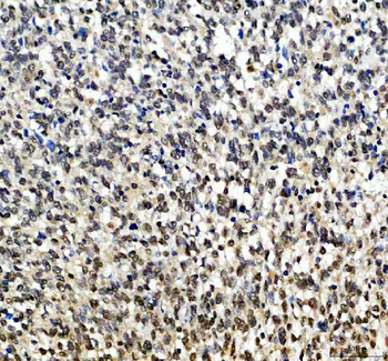 Anti-SOX10 Antibody