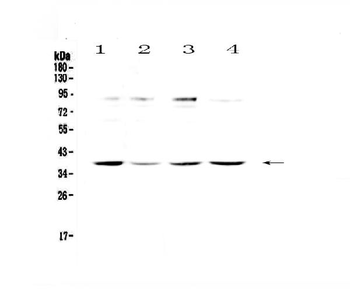 Anti-Ogg1 Antibody