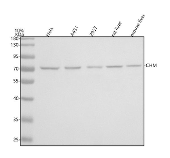 Anti-CHM Antibody