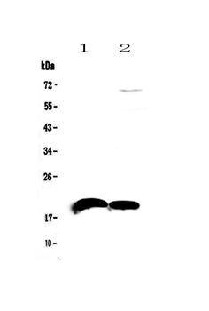 Anti-IL22 Antibody