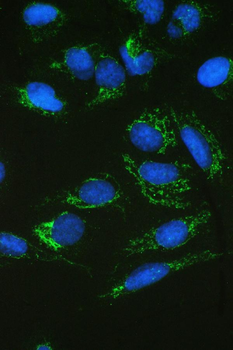Anti-SDHB Antibody