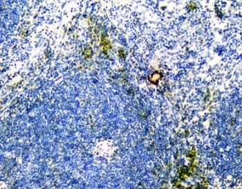 Anti-VCAM1 Antibody