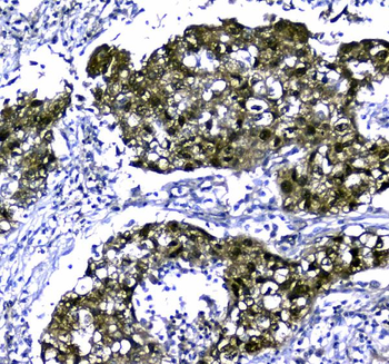 Anti-STUB1 Antibody