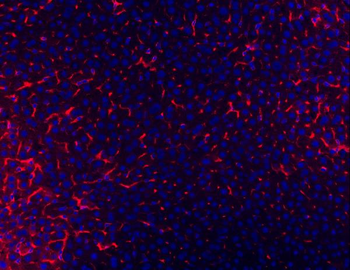 Anti-TAPA1/Cd81 Antibody