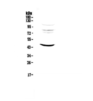 Anti-MVD Antibody