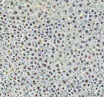 Anti-DCK Antibody