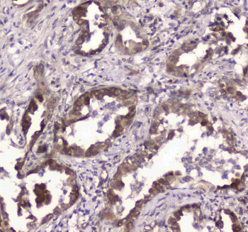 Anti-GLO1 Antibody