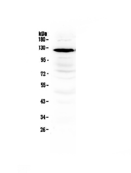 NMDAR1/GRIN1 Antibody