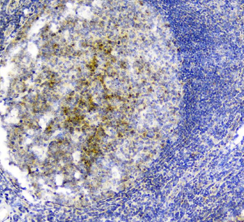 Anti-PLK2 Antibody