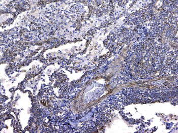 Anti-GSTM3 Antibody