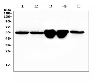 Anti-Vitamin D Binding protein/Gc Antibody