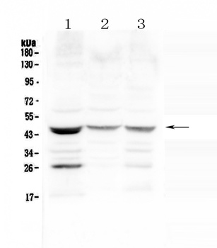 Prosurfactant Protein B/SFTPB Antibody
