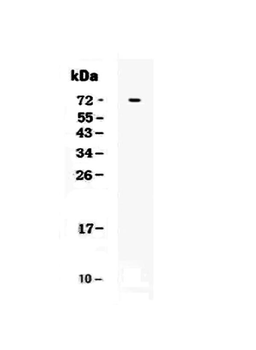 Anti-CRLF2 Antibody