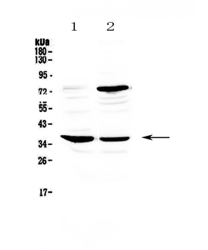 Anti-CD23/FCER2 Antibody