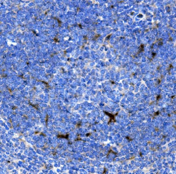 Anti-CXCL12 Antibody