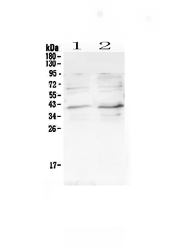 Anti-CCR5 Antibody
