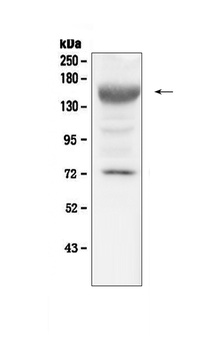 IGF1 Receptor/Igf1r Antibody