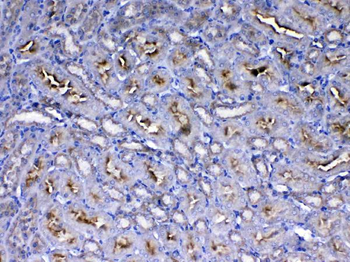 Anti-IGF1 Receptor/Igf1r Antibody