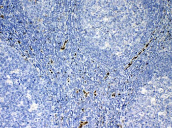 Anti-IL33 Antibody