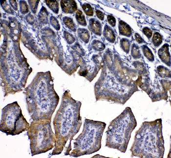 Anti-IL33 Antibody