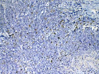 Anti-IL33 Antibody