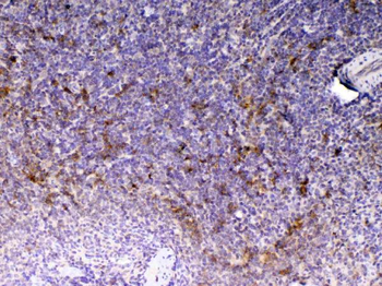 Anti-CD14 Antibody
