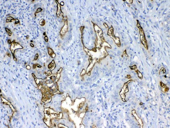 Anti-MUC1 Antibody