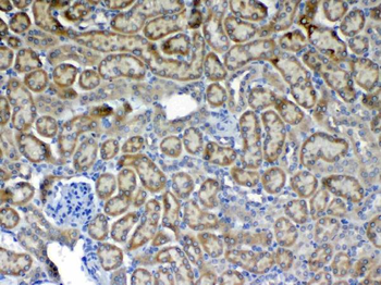 Anti-Flt3/CD135 Antibody