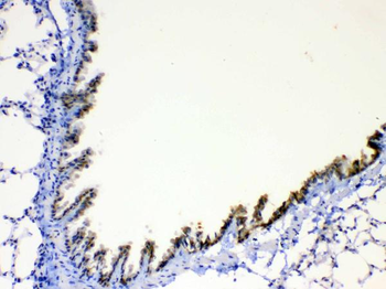 Anti-AGRP Antibody