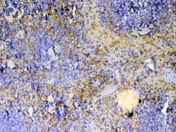 Anti-ICOS Antibody