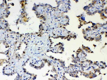 Anti-ETV6/Tel Antibody