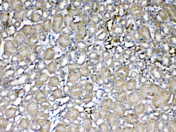Anti-GST3/GST pi/Gstp1 Antibody
