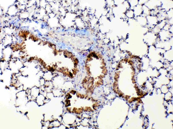 Anti-MMP13 Antibody