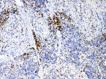 Anti-IL17/Il17a Antibody