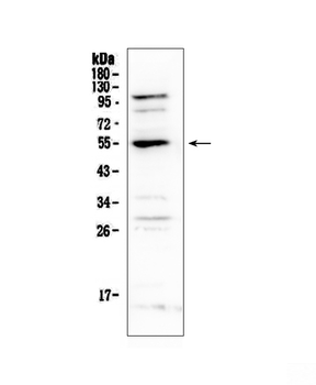 Anti-EPO Receptor/EPOR Antibody