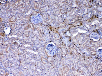 Anti-Galectin 1/Lgals1 Antibody