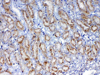 Anti-Galectin 1/Lgals1 Antibody