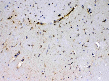 Anti-Sacsin Antibody