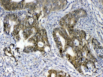 Anti-GALE Antibody