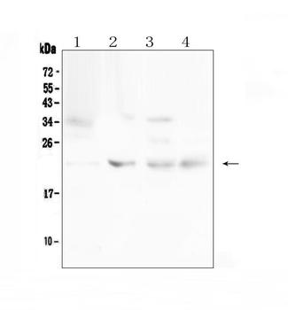 Anti-TIMP1 Antibody