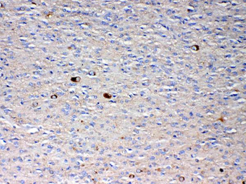 Anti-NSF Antibody